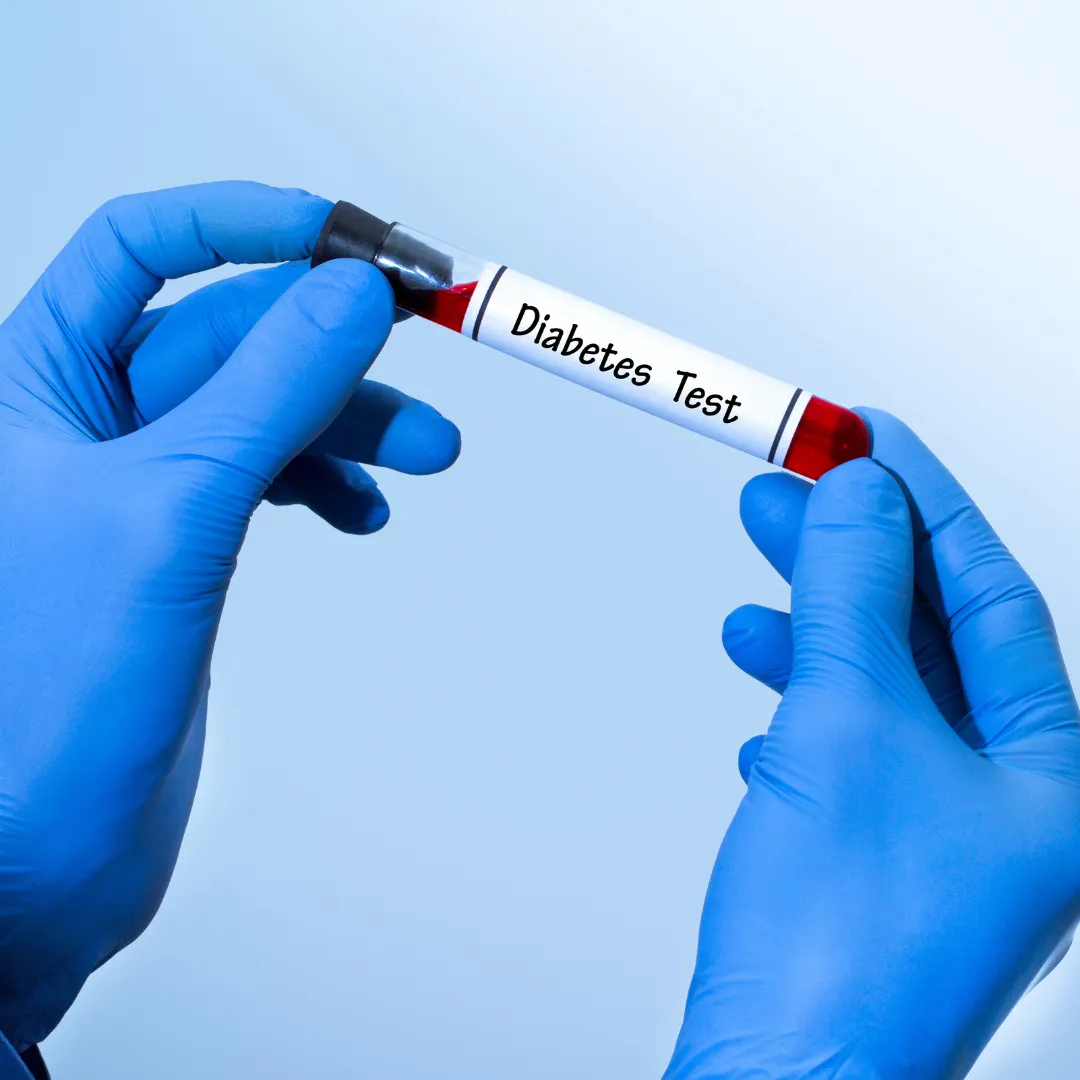 blood sugar tests in Coimbatore