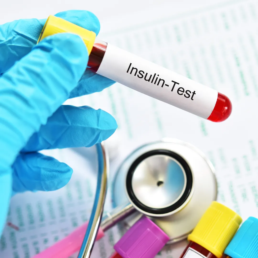 Insulin Management