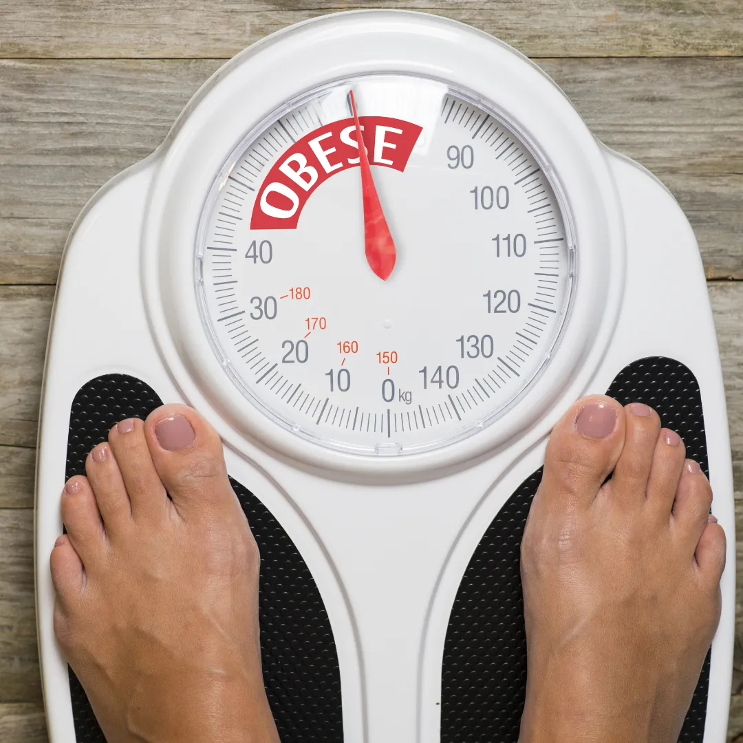 Obesity Management For Diabetes in Coimabtore