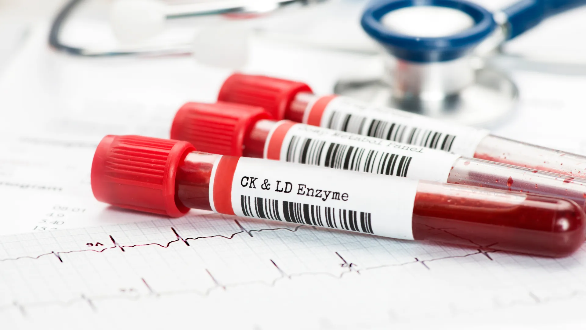 Blood Tests